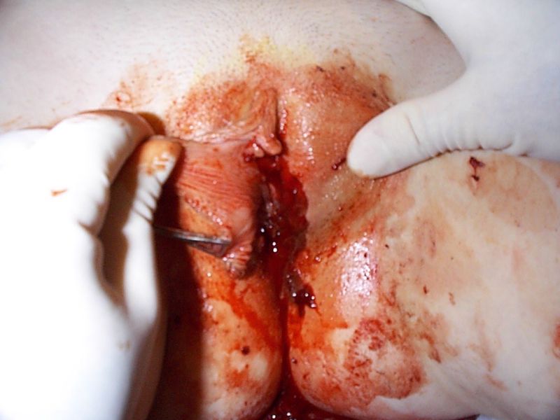 Sara labiacut — 19